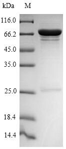 Recombinant Influenza A virus Nucleoprotein(NP)