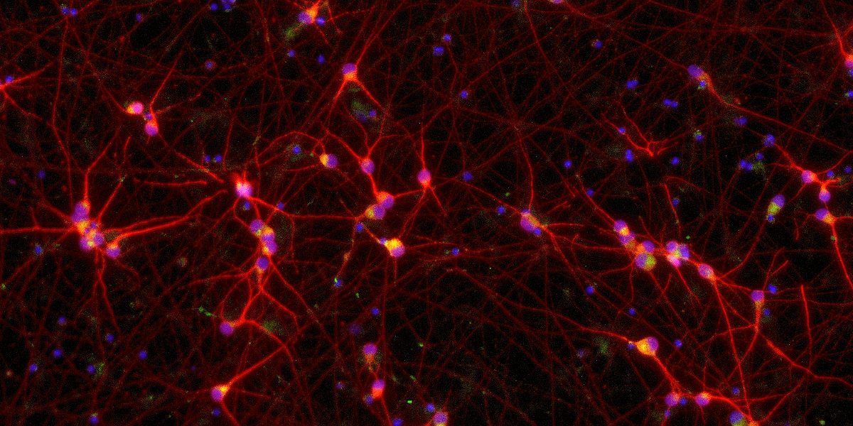 [ioEA1006] ioGlutamatergic Neurons TDP-43 M337V/WT
