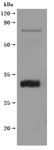 Recombinant Macaca fascicularis Claudin(CLDN18)-VLPs (Active)