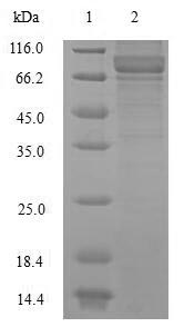 Recombinant Human Neurofilament light polypeptide(NEFL) 